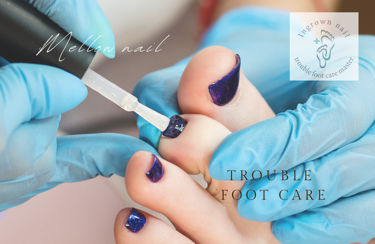 巻き爪ケアジェル「ヘイスイッチ」が学べるスクール｜大阪市で巻き爪ケアジェルを学ぶならMellow nail