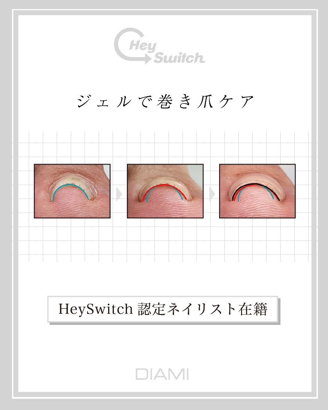 ダウンロード