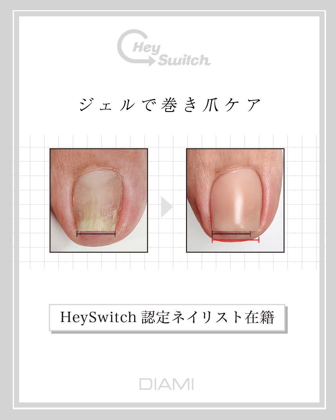 ダウンロード